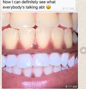 Linic-lixiviación de 10 ins ydrogen, eroxi, istem - Product Image 5