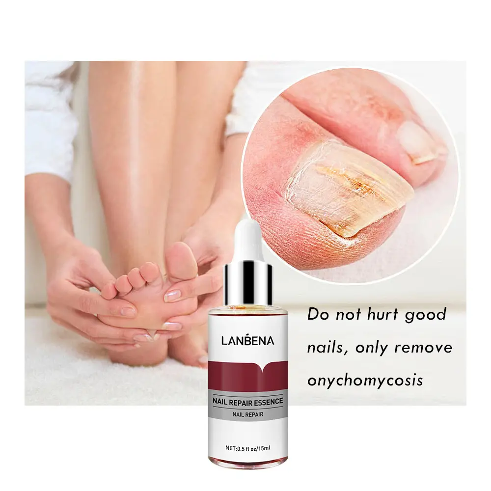 LANBENA Anti Fungal Anti Bacterial Nail Repair Essence To Help Remove Nail Fungus and Grow New Nail