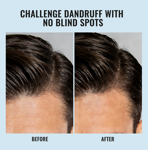 Shampooing Quotidien Hydratant et Séborégulateur pour Hommes, Tous Types de Cheveux, Sans Sulfates, Marque Blanche - Product Image 6