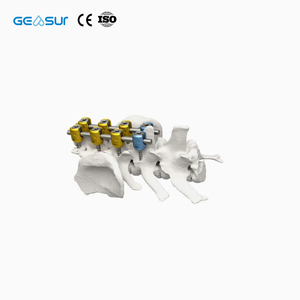 <span class=keywords><strong>Tornillo</strong></span> Pedicular de Titanio con Certificación CE e ISO de Geasure - Implante Ortopédico de Clase III con <span class=keywords><strong>1</strong></span> Año de Garantía Hecho en China - Product Image 4