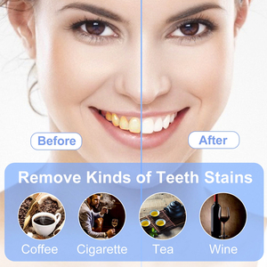 Kit de <span class=keywords><strong>blanchiment</strong></span> dentaire à domicile avec lumière LED, logo personnalisé, produit pour des dents blanches et un sourire éclatant - Product Image 6
