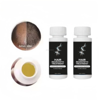 Huile capillaire en gros OEM pour usines : Sérum de croissance naturel à base de plantes avec applicateur roll-on, à l'huile de coco, pour réparer, épaissir et volumiser les cheveux