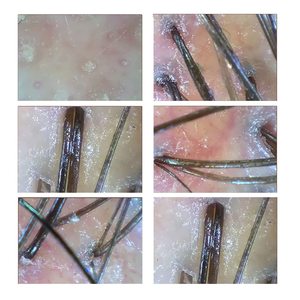 Detector de Piel y Cabello, Analizador de Cuero Cabelludo con Detección de Folículos Pilosos, Dispositivo de Belleza Multifuncional Tipo Caja con Salida USB - Product Image 3