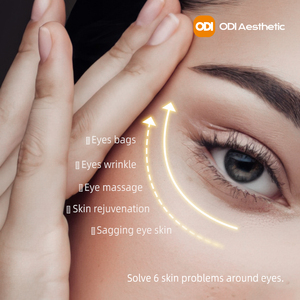 Appareil de soin des yeux 3 en 1, radiofréquence monopolaire + introduction de sérum + massage, appareil de suppression des poches sous les yeux, appareil de raffermissement de <span class=keywords><strong>la</strong></span> peau par radiofréquence - Product Image 3