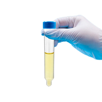 Tubo de Recolección de Muestras de Orina de 12 ml con Tapa de Rosca, Recipiente para Orina, Tubos de Ensayo para Centrífuga de Sedimentos, Suministros de Laboratorio
