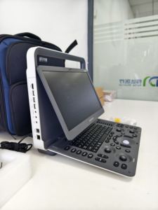 <span class=keywords><strong>Sonoscape</strong></span> <span class=keywords><strong>E1</strong></span> Veterinary Color Doppler portátil máquina de ultrasonido médico 3D 4D diagnóstico de animales precio competitivo veterinario - Product Image 5