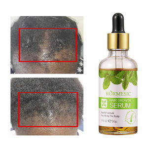 KORMESIC all'ingrosso Lablels privati OEM crescita dei capelli essenza di riparazione crescita dei capelli organico olio per capelli - Product Image 2