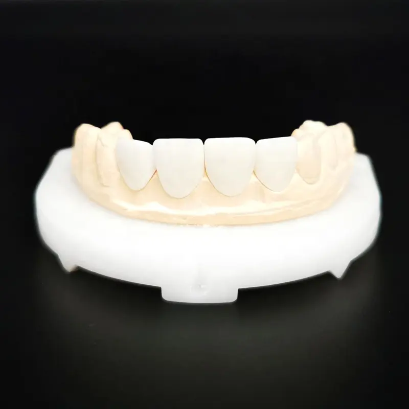 Отбеливание зубов шпон ультра тонкий фарфоровый шпон отбеливание зубов для улучшения редких фтороза пигментных зубов