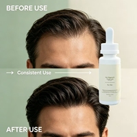 Sérum de croissance capillaire biologique à base de plantes 60 ml, traitement de repousse des cheveux à 5 % de biotine, essence réparatrice des cheveux, soin anti-chute de cheveux