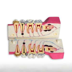 Modelo de Descomposición de Tejido de la Mandíbula Inferior Derecha |   Modelo de Anatomía del Diente del Sabiduría para Entrenamiento, Educación y Exámenes en Clínicas Dentales - Product Image 3