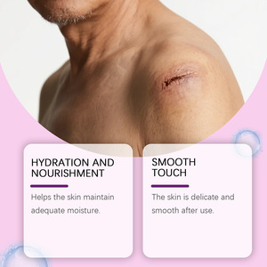 Crème anti-vergetures K01 60g avec vitamine E, nourrissante pour le corps, convient à tous les types de peau, femmes, adultes, impression sérigraphique - Product Image 4