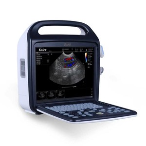 Máquina de Ultrasonido Veterinaria Kaier, Doppler a Color, Portátil, para Detección de Embarazo en Animales como Cerdos, Vacas y Ovejas - Product Image 1