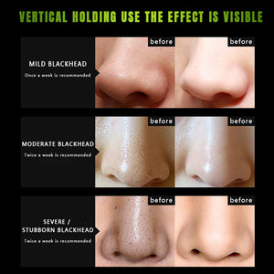 OEM/ODM <span class=keywords><strong>Masque</strong></span> de boue pour le visage avec dissolvant de tête noire <span class=keywords><strong>Masque</strong></span> <span class=keywords><strong>noir</strong></span> pour le visage Traitements de l'acné <span class=keywords><strong>Masque</strong></span> <span class=keywords><strong>noir</strong></span> à décoller des points noirs Soins de la peau - Product Image 4