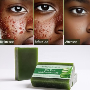 Axit Salicylic mát tươi lô hội xà phòng làm sạch lỗ chân lông tẩy tế bào chết chống mụn làm mềm da chống mụn xà phòng chăm sóc da - Product Image 2