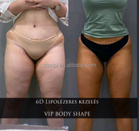 Longue garantie, Fat Laser 6D, Lipo Laser sans chirurgie / lipolaser Monteria / 6D Lipolaser / résultats laser pour amincissement corporel
