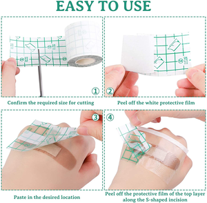 سعر المصنع المورد الصانع شفاف لاصق بو فيلم الجروح خلع الملابس الطبية بو خلع الملابس لفة للعناية بالجروح - Product Image 5