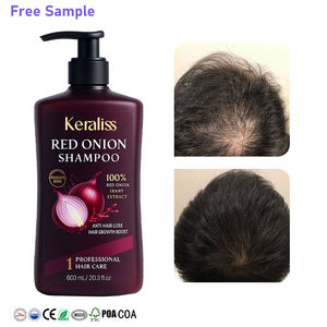 Joynna para adultos azul suavizar Mini larga duración Nanoplastia Vegan Polygonum Anti caída del cabello Marruecos champú Regrow Hair hombres - Product Image 1