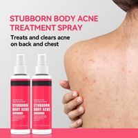 Spray anti-acné en vente chaude pour réduire les rougeurs, les gonflements et inhiber les bactéries, contrôle de l'acné du dos
