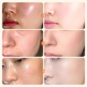 มาส์กหน้าบำรุงผิวหน้าสูตรไฮยาลูรอน วิตามินซี คอ<span class=keywords><strong>ล</strong></span><span class=keywords><strong>ล</strong></span>าเจน ไนอะซินาไมด์ ขมิ้น ช่วยเติมความชุ่มชื้น <span class=keywords><strong>ราคา</strong></span>โรงงาน - Product Image 3