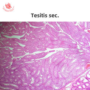 Eierstöcke Medizinische Wissenschaft Hochschul bildung Eierstock Abschnitt <span class=keywords><strong>Human</strong></span> histologie Folien - Product Image 6