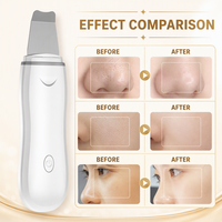 Esfoliador Facial Ultrassônico Portátil, Espátula para Limpeza de Pele, Removedor de Cravos, Limpador de Poros, Esfoliador Facial Sônico