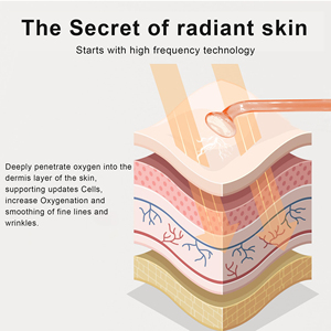 เครื่องมือบำบัดด้วยไฟฟ้าความถี่สูงขายดี ช่วยลดรอยแดงและความร้อน กระตุ้นการไหลเวียนโลหิต อุปกรณ์เสริมความงามสำหรับใช้ในบ้าน - Product Image 5