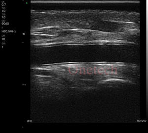 Échographe <span class=keywords><strong>portable</strong></span> sans fil C37G Clinic à haute fréquence pour l'analyse des couches et structures du visage, scanner d'imagerie couleur pour interventions esthétiques - Product Image 4