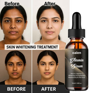 Vitamine C Sérum Sérum Visage Soins <span class=keywords><strong>de</strong></span> la <span class=keywords><strong>Peau</strong></span> Blanchiment <span class=keywords><strong>de</strong></span> la <span class=keywords><strong>Peau</strong></span> Sérum Visage Essence Blanchissant Éclaircir - Product Image 2