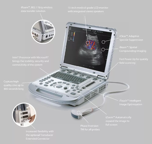 Appareil d'échographie portable Mindray M7, appareil d'échocardiographie, <span class=keywords><strong>prix</strong></span> M9 - Product Image 3