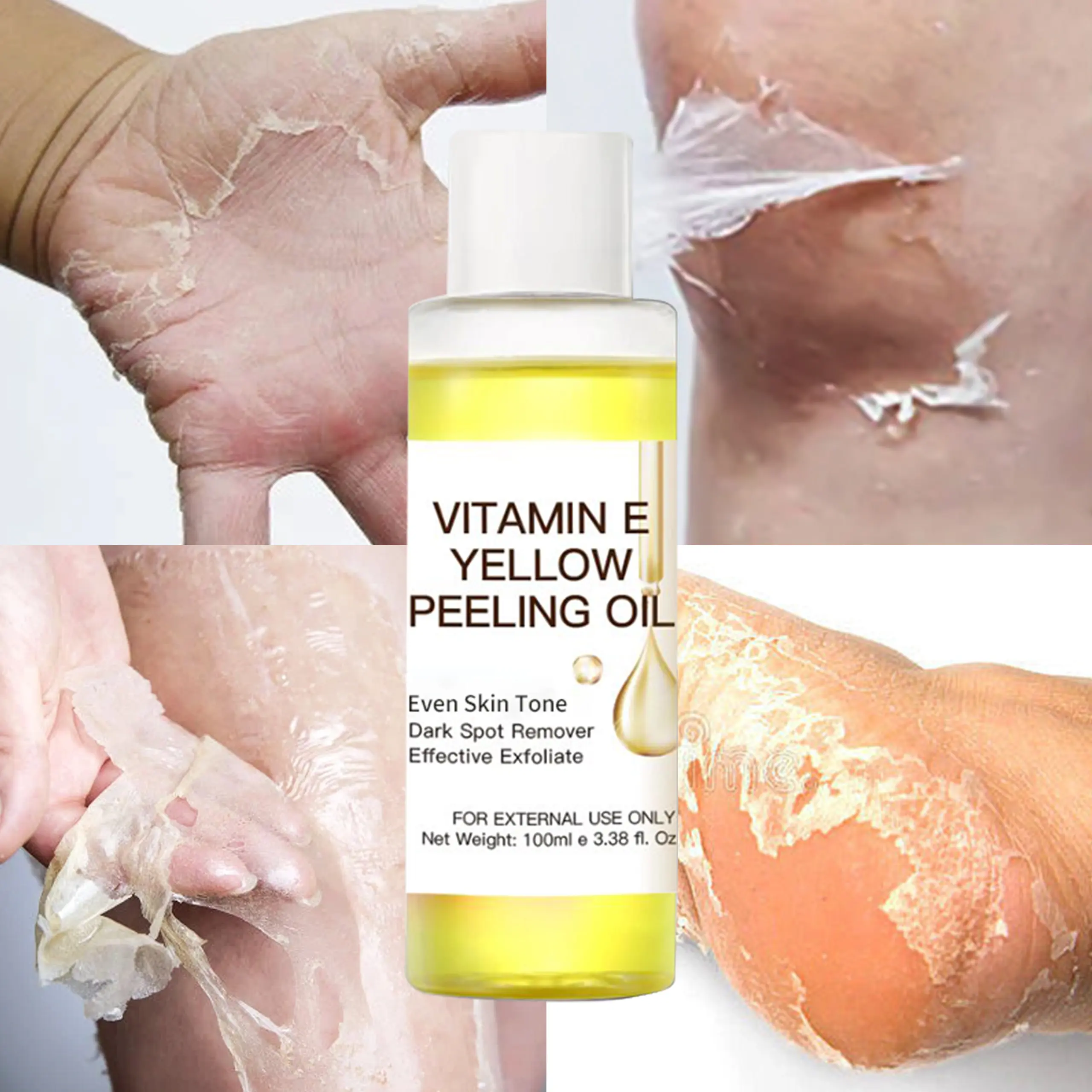 High-strength Face And Body Legs Scars Dark Knuckles Skin Whitening Remove Dead Skin Exfoliating Yellow Peeling Oil