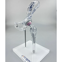 Modèle d'implant de hanche transparent KyrenMed, modèle de remplacement, mini taille, modèle d'affichage générique transparent