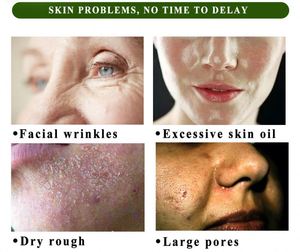 Suero Facial Yoxier Hidratante, Elimina Puntos Negros, Blanqueador, Antiarrugas, Antienvejecimiento, Concentrado de Seis Péptidos de Caracol, Cuidado de la Piel - Product Image 5