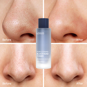 Marque privée 100ml nettoyage des pores points noirs Toner pour le visage exfoliant Aha <span class=keywords><strong>Bha</strong></span> Pha toner rétrécissant les pores pour le visage - Product Image 3