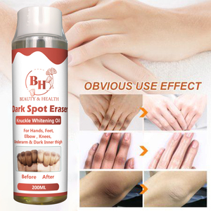 Aceite Blanqueador de Semillas de Vitamina E Frescas de Marca Privada, Reducción Efectiva de Manchas Oscuras, Reducción de Melanina, Blanqueamiento de Piernas y Codos, Esencial Puro - Product Image 4