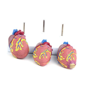 Model penyakit jantung medis 3 buah, Model anatomi jantung manusia ukuran alami, organ Sains jantung pendidikan - Product Image 2