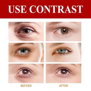 EELHOE ครีมบำรุงรอบ<span class=keywords><strong>ดวงตา</strong></span>เรตินอล ครีมบำรุงผิว<span class=keywords><strong>รอบ</strong></span><span class=keywords><strong>ดวงตา</strong></span> ลดเลือนริ้วรอย ต่อต้านริ้วรอย ต่อต้านริ้วรอย <span class=keywords><strong>ยก</strong></span><span class=keywords><strong>กระชับ</strong></span> 15 มล - Product Image 6