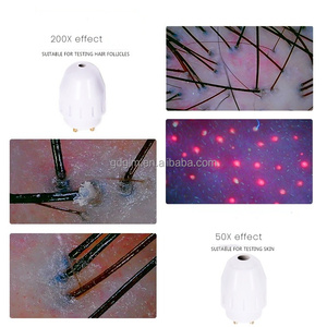 Analizzatore del Cuoio Capelluto di Grado Professionale da 15 Pollici, Scanner per Follicoli Capillari per Cliniche di Cura dei Capelli - Product Image 5