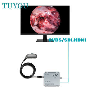 Kamera endoskop portabel, endoskopi ENT untuk penggunaan klinik 1080P definisi - Product Image 2