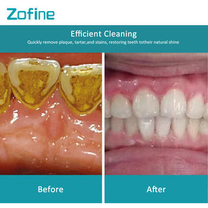 Zofine Z31 Détartreur Portable à Jet de Sable <span class=keywords><strong>Dentaire</strong></span> Certifié CE de Classe Médicale I pour le Polissage des Dents 1 - Product Image 2