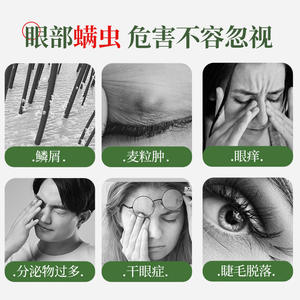 Toallitas de aceite de pino Super Asia, 20 unidades, pañuelos limpiadores para el cuidado de los ojos, para aliviar la sequedad ocular - Product Image 2