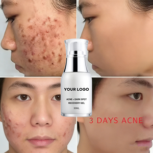เจลแต้มสิวสูตรเร่งด่วน Make Your Logo ลดรอยดำ รอยแดง ควบคุมความมัน บำรุงผิว ช่วยฟื้นฟูผิวที่ถูกทำร้ายจาก<span class=keywords><strong>สิว</strong></span> ขนาด 30 มล. - Product Image 3