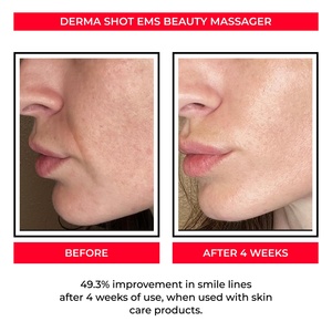 NUEVO Masajeador Facial Eléctrico R, Producto Patentado, Herramienta de Masaje Facial Eléctrico Recargable con Microcorriente - Product Image 6