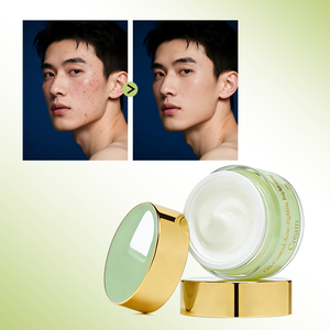 Crème Réparatrice Anti-Acné et Anti-Imperfections pour le Visage avec Extrait d'Arbre à Thé et de Centella Asiatica, Contrôle du Sébum et <span class=keywords><strong>Acide</strong></span> Salicylique - Product Image 2