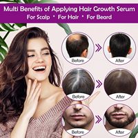 Huile de sérum pour traitement de la perte de cheveux naturelle, biotine, repousse, croissance des cheveux incarnés, pour les cheveux abîmés