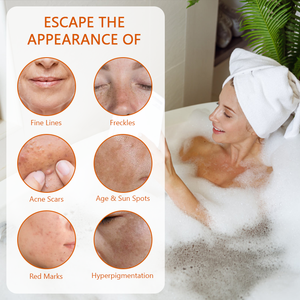 OEM burro di karité pelle nutriente idratante olio d'oliva vitamina C <span class=keywords><strong>sapone</strong></span> 7 giorni schiarente rapido sbiancamento della pelle <span class=keywords><strong>sapone</strong></span> acido kojico - Product Image 4