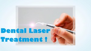 2023 באיכות גבוהה נייד 980nm שיניים דיודה לייזר 60W אוראלי רך רקמות ניתוח לייזר - Product Image 5