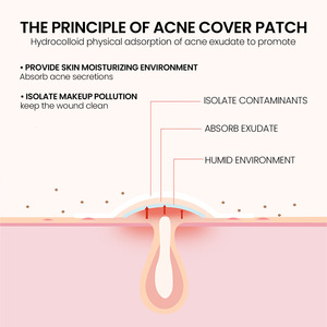 2024 venta al por mayor Jaysuing hidrocoloide acné espinillas parche para cubrir zits forma de estrella colorida parche de tamaño especial - Product Image 2
