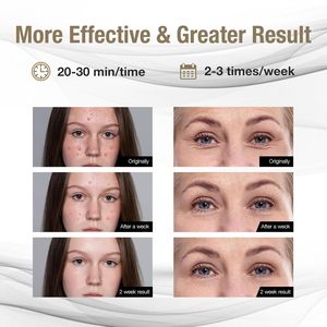 Masque facial LED de luminothérapie rouge et bleue, traitement <span class=keywords><strong>anti</strong></span>-âge et <span class=keywords><strong>anti</strong></span>-acné, <span class=keywords><strong>appareil</strong></span> de soin de la peau, masque de beauté pour la maison et le salon, pour les <span class=keywords><strong>rides</strong></span> et les rougeurs - Product Image 6