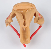 Modèle d'utérus et d'ovaires humains simulés, simulateur d'organes reproducteurs féminins en silicone pour la formation en chirurgie gynécologique
