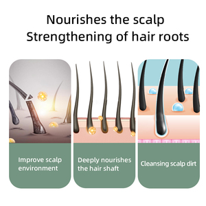 <span class=keywords><strong>แชมพู</strong></span>ธรรมชาติปรับแต่งได้สำหรับดูแลห<span class=keywords><strong>น</strong></span>ังศีรษะป้องกันอาการคันทำให้รู้สึกสดชื่<span class=keywords><strong>น</strong></span>ควบคุม<span class=keywords><strong>น</strong></span>้ำมั<span class=keywords><strong>น</strong></span><span class=keywords><strong>น</strong></span>ุ่มสมุ<span class=keywords><strong>น</strong></span>ไพร - Product Image 5